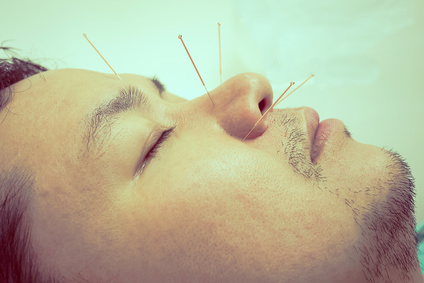 Man with Acupuncture Therapy